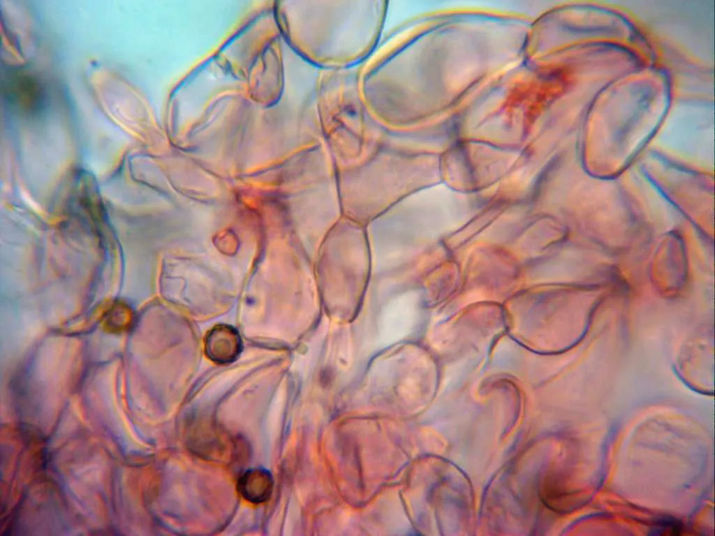 Microscopía de Lycoperdon mammiforme - 10 - Exoperidio x 1000 3
